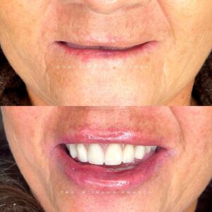 325384187_715137616833241_1402238212393769995_n