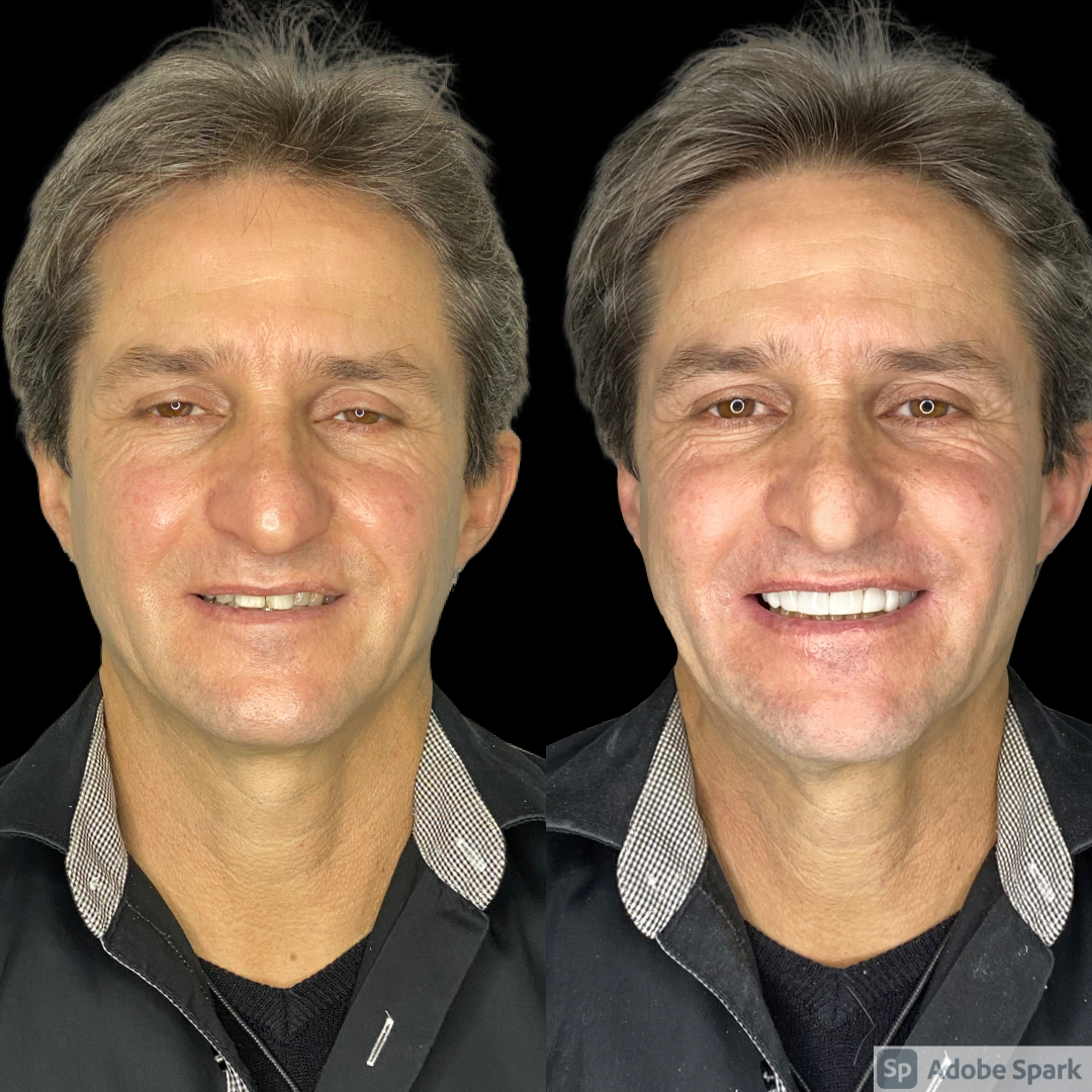 73831E30-46BB-42E9-825D-701E0DAACC99 (2)